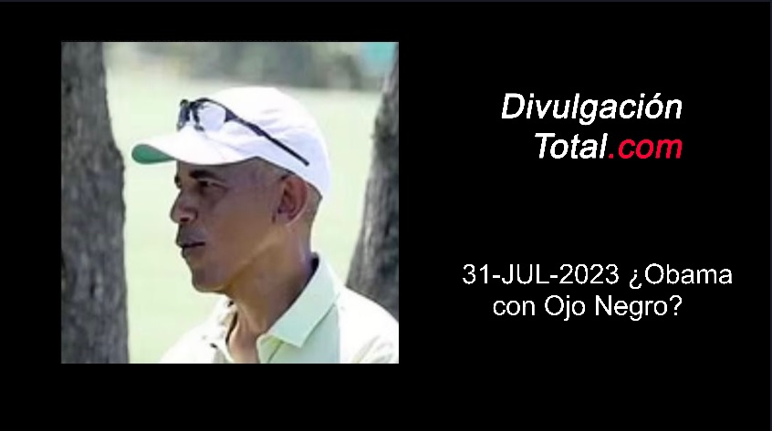 31-JUL-2023 ¿Obama con Ojo Negro? - Divulgación Total